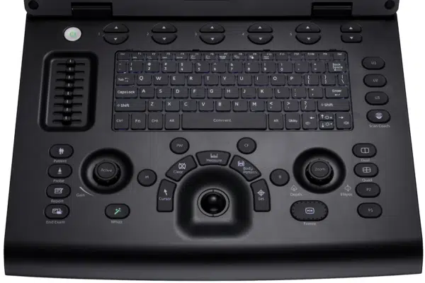 GE HealthCare Versana Active - Image 5