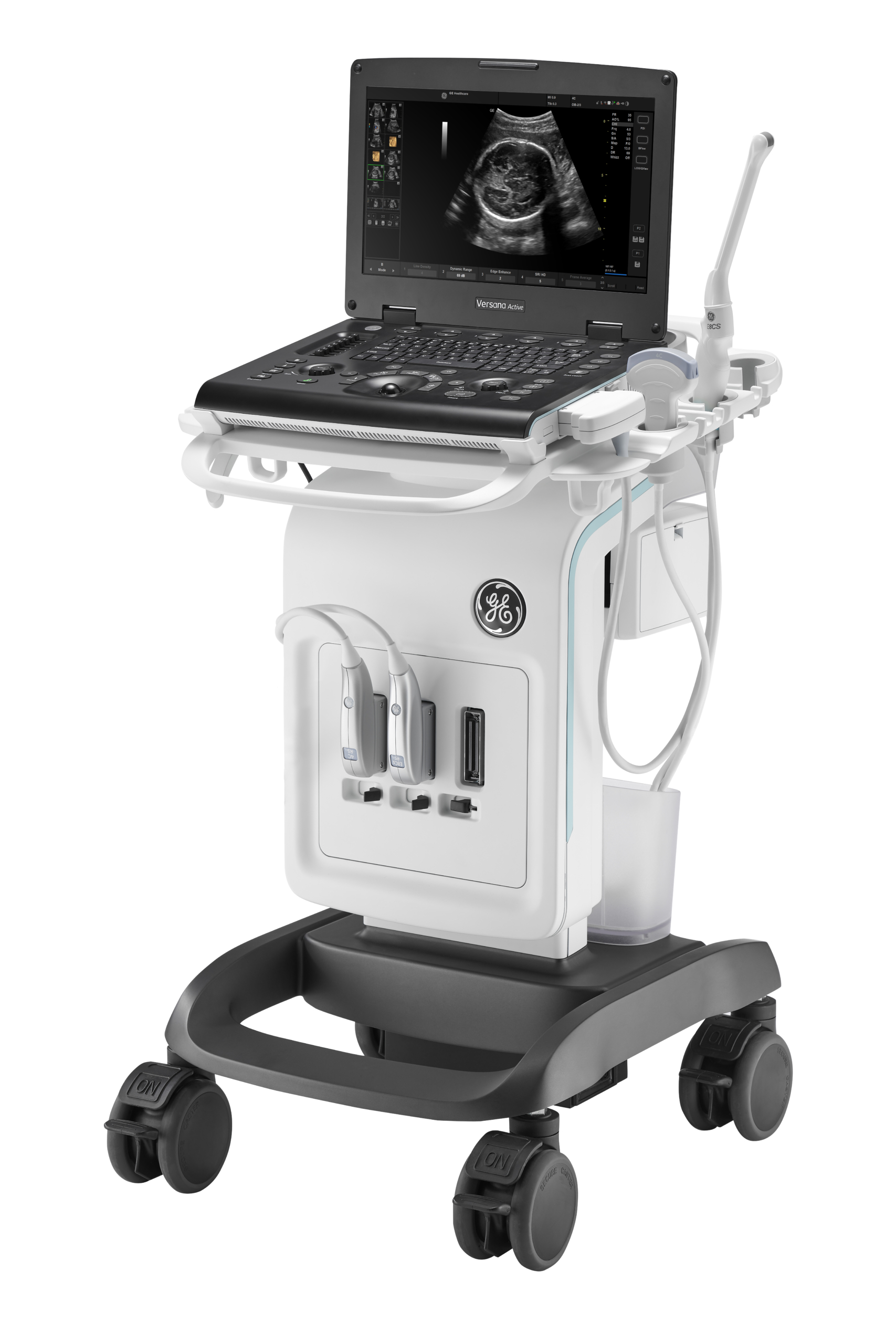 GE HealthCare Versana Active - Image 4