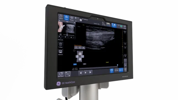 GE HealthCare Venue Sprint - Image 5